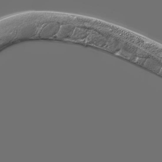 Scientists Upload the Mind of a Worm Into Computer and Teach It Tricks
