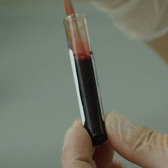 Checking For Liquification of Psychic Dried Blood For Prediction on Pandemic